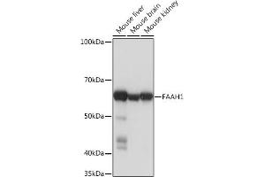 Western blot analysis of extracts of various cell lines, using F Rabbit mAb (ABIN1682600, ABIN3018533, ABIN3018534 and ABIN7101623) at 1:1000 dilution. (FAAH antibody)