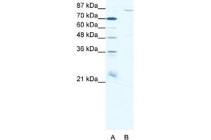 WB Suggested Anti-MEFV Antibody Titration:  0.