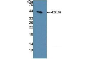 Detection of Recombinant SDH, Rat using Polyclonal Antibody to Sorbitol Dehydrogenase (SDH) (SORD antibody  (AA 2-357))