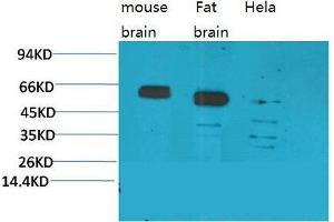 Western Blot (WB) analysis of 1) Mouse Brain Tissue, 2)Rat Brain Tissue, 3)Human Brain Tissue, with CCKBR Rabbit Polyclonal Antibody diluted at 1:2000. (CCKBR antibody)