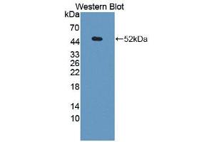 Western blot analysis of the recombinant protein. (Androgen Receptor antibody  (AA 156-310))