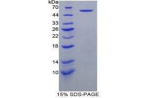 SDS-PAGE of Protein Standard from the Kit (Highly purified E. (HSPD1 ELISA Kit)