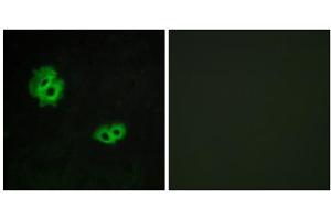 Immunofluorescence analysis of MCF-7 cells, using GPR171 antibody.