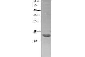 Western Blotting (WB) image for Adaptor-Related Protein Complex 1, sigma 2 Subunit (AP1S2) (AA 1-157) protein (His tag) (ABIN7121698) (AP1S2 Protein (AA 1-157) (His tag))
