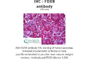 Image no. 1 for anti-Ferredoxin Reductase (FDXR) antibody (ABIN1734312)