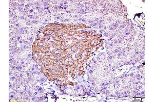 Formalin-fixed and paraffin embedded mouse pancreas labeled with Anti-Insulin Polyclonal Antibody, Unconjugated (ABIN724265) 1:200 followed by conjugation to the secondary antibody and DAB staining