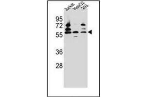 Western blot analysis of PDP1 Antibody (Center) in Jurkat,HepG2,293 cell line lysates (35ug/lane). (PDP antibody  (Middle Region))