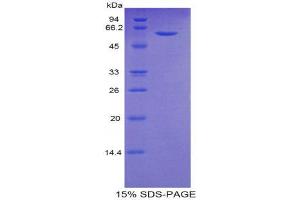 SDS-PAGE (SDS) image for Complement Factor B (CFB) (AA 34-159) protein (His tag,MBP tag) (ABIN1981042)