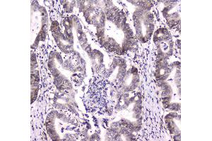 IHC analysis of DGCR8 using anti-DGCR8 antibody . (DGCR8 antibody  (AA 561-762))