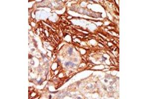Image no. 1 for anti-V-Raf Murine Sarcoma 3611 Viral Oncogene Homolog (ARAF) (Middle Region) antibody (ABIN360127) (ARAF antibody  (Middle Region))
