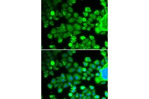 Immunofluorescence analysis of MCF-7 cells using RPS10 antibody (ABIN6132945, ABIN6147192, ABIN6147194 and ABIN6221686).