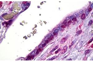 Anti-SMO antibody IHC staining of human placenta, cytotrophoblast.