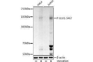 Western blot analysis of extracts of various cell lines, using Phospho-ULK1-S467 antibody (ABIN7271218) at 1:1000 dilution. (ULK1 antibody  (pSer467))