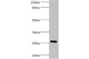 Western blot All lanes: IL27 antibody at 2 μg/mL + Mouse liver tissue Secondary Goat polyclonal to rabbit IgG at 1/10000 dilution Predicted band size: 27 kDa Observed band size: 27 kDa (IL-27 antibody  (AA 29-243))