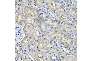 Immunohistochemistry of paraffin-embedded rat kidney using ACO1 antibody (ABIN5995389) at dilution of 1/100 (40x lens). (Aconitase 1 antibody)