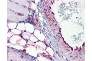 IHC Information: Paraffin embedded mouse vessel and adipocytes (skeletal muscle) tissue, tested with an antibody dilution of 5 ug/ml. (PTRF antibody  (Middle Region))