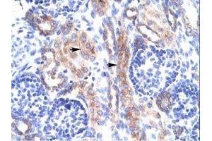 Image no. 1 for anti-RAR-Related Orphan Receptor A (RORA) (AA 50-99) antibody (ABIN202757) (RORA antibody  (AA 50-99))