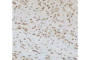 IHC analysis of THAP11 using anti-THAP11 antibody (ABIN7599230). (THAP11 antibody  (AA 1-294))