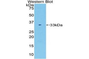 Western blot analysis of the recombinant protein. (FUCA1 antibody  (AA 170-420))