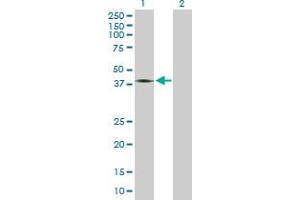 Western Blot analysis of GRIK2 expression in transfected 293T cell line ( H00002898-T03 ) by GRIK2 MaxPab polyclonal antibody. (GRIK2 antibody  (AA 1-353))