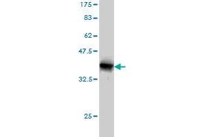 Western Blot detection against Immunogen (37. (SMG1 antibody  (AA 2922-3031))