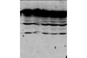 Image no. 1 for anti-Cyclin-Dependent Kinase 1 (CDK1) (C-Term) antibody (ABIN221143) (CDK1 antibody  (C-Term))