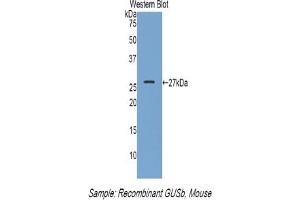 Detection of Recombinant GUSb, Mouse using Polyclonal Antibody to Glucuronidase Beta (GUSb) (Glucuronidase beta antibody  (AA 451-648))