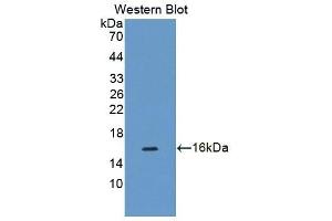 Detection of Recombinant CDK2AP1, Human using Polyclonal Antibody to Cyclin Dependent Kinase 2 Associated Protein 1 (CDK2AP1) (CDK2AP1 antibody  (AA 1-115))