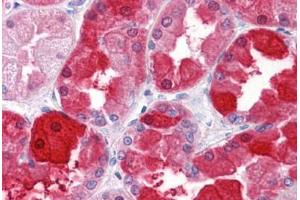 Human Kidney: Formalin-Fixed, Paraffin-Embedded (FFPE) (CRYM antibody  (AA 215-315))