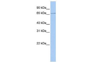 WB Suggested Anti-SCMH1 Antibody Titration: 0. (SCMH1 antibody  (Middle Region))