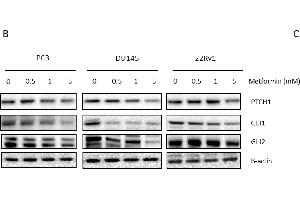 Link between metformin and Hedgehog signaling. (GLI2 antibody  (AA 30-65))