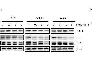 Link between metformin and Hedgehog signaling. (GLI2 antibody  (Internal Region))