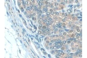 Immunohistochemistry (IHC) image for anti-Interleukin 22 Receptor, alpha 2 (IL22RA2) (AA 31-223) antibody (ABIN7435862)