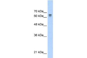 WB Suggested Anti-PAntibody Titration:  0. (PARP6 antibody  (C-Term))