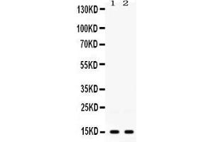 Western blot analysis of ISG15 expression in 22RV1 whole cell lysates ( Lane 1) and HELA whole cell lysates ( Lane 2). (ISG15 antibody  (AA 2-157))