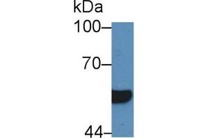 Detection of HNF1b in Human Serum using Polyclonal Antibody to Hepatocyte Nuclear Factor 1 Beta (HNF1b) (HNF1B antibody  (AA 159-300))