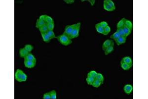 Immunofluorescent analysis of PC-3 cells using ABIN7162039 at dilution of 1:100 and Alexa Fluor 488-congugated AffiniPure Goat Anti-Rabbit IgG(H+L) (NME3 antibody  (AA 20-169))
