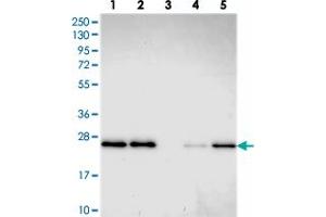 Western blot analysis of Lane 1: RT-4, Lane 2: U-251 MG, Lane 3: Human Plasma, Lane 4: Liver, Lane 5: Tonsil with GDF6 polyclonal antibody .