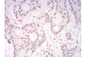 Immunohistochemical analysis of paraffin-embedded HeLa tissues using DDX39B mouse mAb with DAB staining. (DDX39B antibody  (AA 1-250))