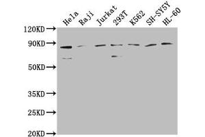 Western Blot Positive WB detected in: Hela whole cell lysate, Raji whole cell lysate, Jurkat whole cell lysate, 293T whole cell lysate, K562 whole cell lysate, SH-SY5Y whole cell lysate, HL-60 whole cell lysate All lanes: ZRANB1 antibody at 1:2000 Secondary Goat polyclonal to rabbit IgG at 1/50000 dilution Predicted band size: 81 kDa Observed band size: 81 kDa (ZRANB1 antibody  (AA 111-397))