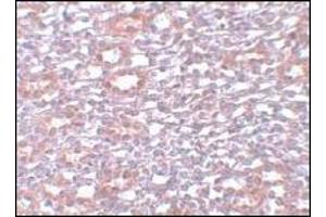 Immunohistochemistry of PIAS1 in rat kidney tissue with PIAS1 Antibody  at 5 μg/ml (PIAS1 antibody  (C-Term))