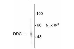 Image no. 2 for anti-Dopa Decarboxylase (Aromatic L-Amino Acid Decarboxylase) (DDC) antibody (ABIN220954) (DDC antibody)