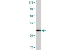 Western Blot detection against Immunogen (36. (Syntaxin 16 antibody  (AA 1-99))