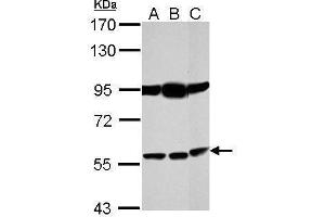 WB Image Sample (30 ug of whole cell lysate) A: NT2D1 B: PC-3 C: SK-N-SH 7. (Bestrophin 1 antibody)