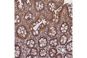 Immunohistochemical staining of human colon with FCHO1 polyclonal antibody  shows moderate cytoplasmic, nuclear and membranous positivity in glandular cells.