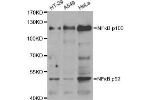 Western blot analysis of extracts of various cell lines, using NFKB2 antibody (ABIN2975984). (NFKB2 antibody)