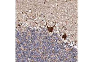 Immunohistochemical staining (Formalin-fixed paraffin-embedded sections) of human cerebellum with ADAMTS2 polyclonal antibody  shows strong positivity in Purkinje cells. (Adamts2 antibody)