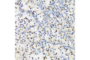 Immunohistochemistry of paraffin-embedded human appendicitis using SUMO4 Antibody (ABIN5971586) at dilution of 1/100 (40x lens). (SUMO4 antibody)