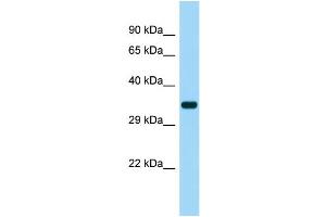 Host: Rabbit Target Name: SUCNR1 Sample Type: Fetal Heart lysates Antibody Dilution: 1. (SUCNR1 antibody  (Middle Region))