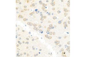 Immunohistochemistry analysis of paraffin embedded mouse brain using Erc2 (ABIN7073808) at dilution of 1: 3000 (ERC2 antibody)
